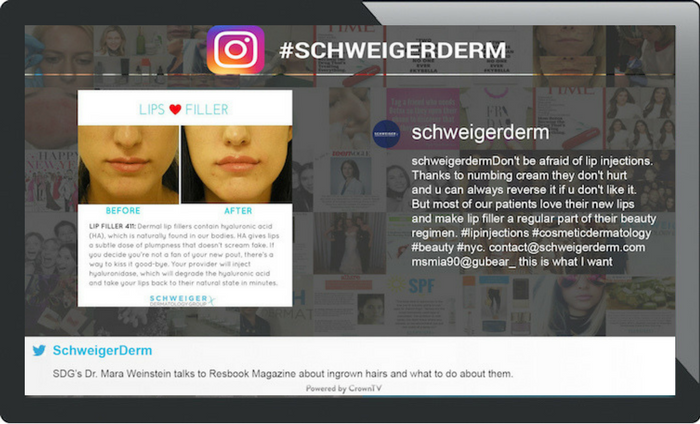 Schweiger instagram before & after